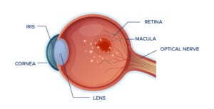 Diagram of the human eye showing labeled parts: cornea, iris, lens, retina, macula, and optic nerve.