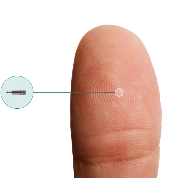 Sample image of iDose TR size comparision to a thumb.