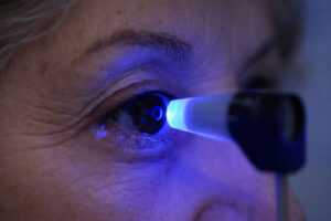 Applanation Tonometry eye pressure test at M&M Eye Institute.